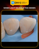 International Schools Working with Composite Restorations