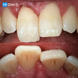 Dental Trauma Without Drama