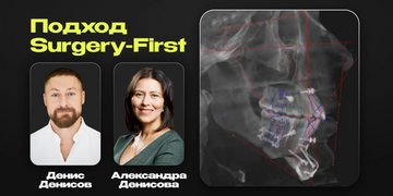 Surgery-First approach. Synchronization of orthodontics and TMJ for predictable aesthetic results