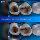 The Biomimetic Concept: Composite Restoration Protocols