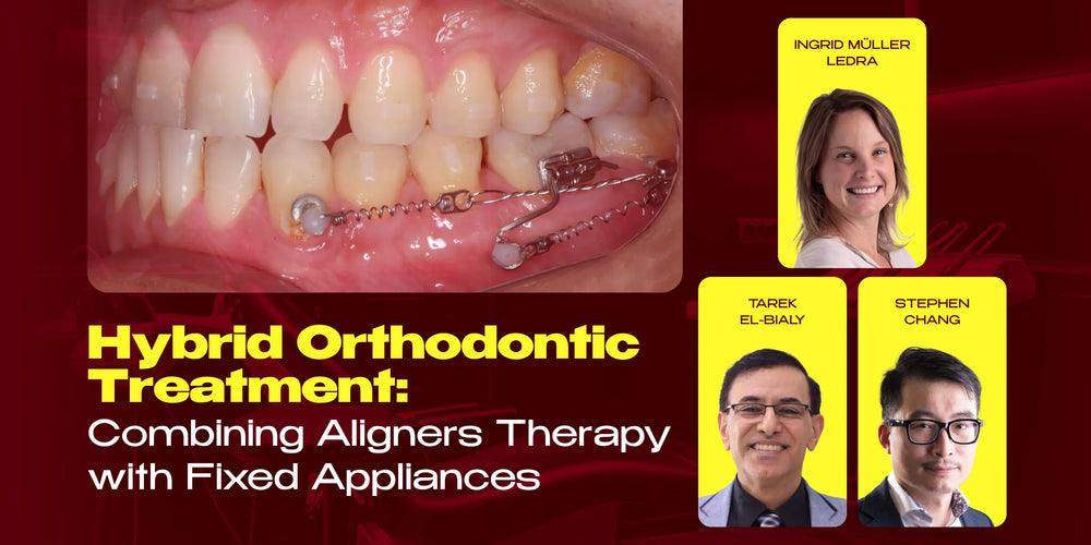 Hybrid Orthodontic Treatment: Combining Aligners Therapy with Fixed Appliances