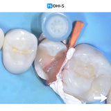 The Biomimetic Concept: Composite Restoration Protocols