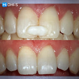 Dental Trauma Without Drama