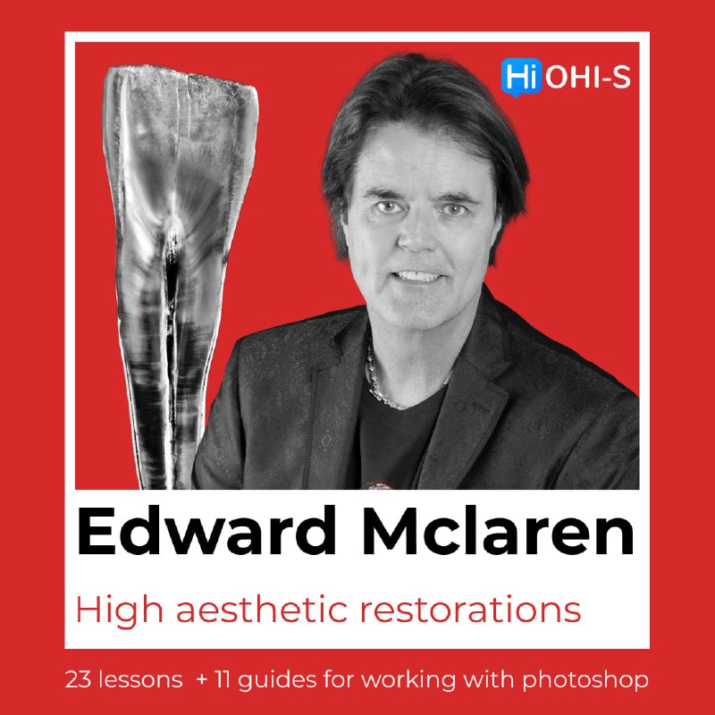 High-Aesthetic Restorations