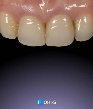 Ceramic Layering: Protocols of the World’s Leading Schools - Dental Courses | كورسات طب اسنان