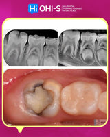 Pediatric Dentistry School