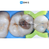 The Biomimetic Concept: Composite Restoration Protocols