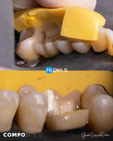 The Biomimetic Concept: Composite Restoration Protocols