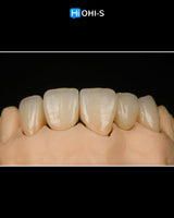 Ceramic Layering: Protocols from the World's Leading Schools