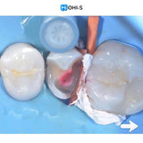The Biomimetic Concept: Composite Restoration Protocols