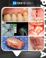 What’s NEW in Endodontics: From Anesthesia to Obturation