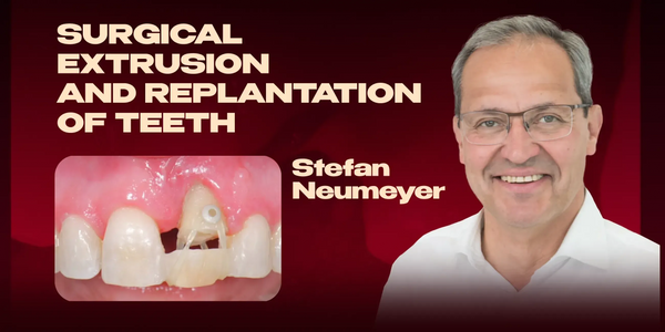 Surgical extrusion and replantation of teeth
