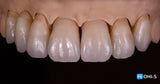 Aesthetic Dentistry Online Congress: Programs by Klaus Müterthies, Edris Rasta and Maurizio De Stefano