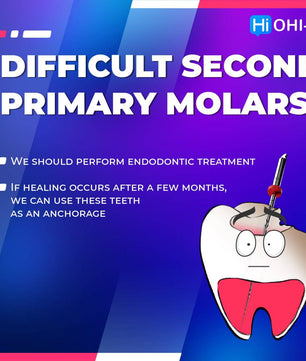 Early Orthodontic Treatment: When and How? - Dental Courses | كورسات طب اسنان