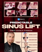 Predictable Sinus Lift