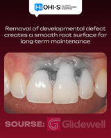 Advanced Periodontology: Surgical Protocols