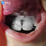 Dental Trauma Without Drama