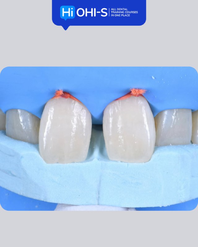 International Schools Working with Composite Restorations