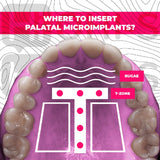 Challenging orthodontic cases: the use of skeletal anchorage