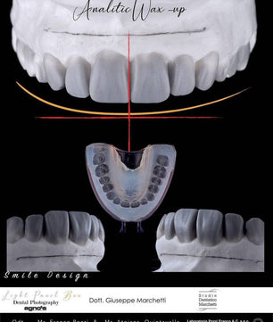 Ceramic Restorations:  Veneers, Inlays, Crowns - Dental Courses | كورسات طب اسنان