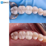 The Biomimetic Concept: Composite Restoration Protocols