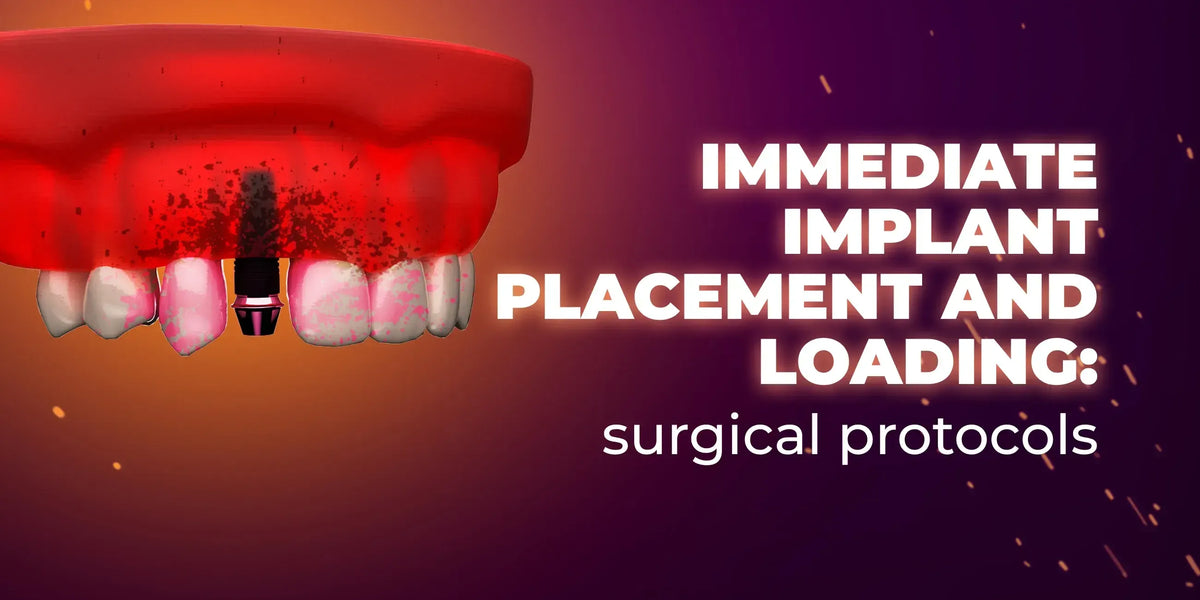 Immediate implant placement and loading: surgical protocols-course