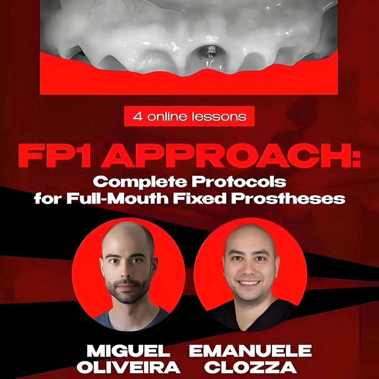 FP1 Approach: Complete Protocols for Full-Mouth Fixed Prostheses - Dental Courses | كورسات طب اسنان
