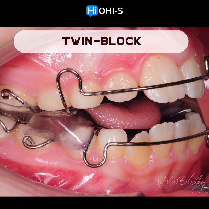 Twin Block and TransForce: Online Course by the Creator