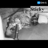 Predictable Sinus Lift