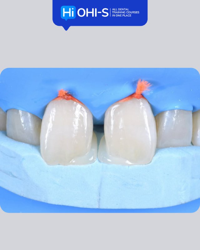 International Schools Working with Composite Restorations