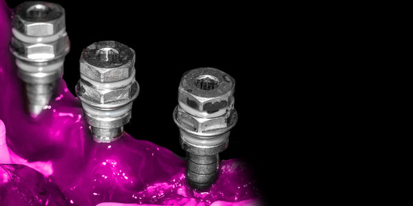 The treatment of the edentulous patient with implants: less invasive for the patient, more feasible for the clinician