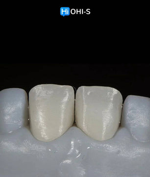 Ceramic Layering: Protocols of the World’s Leading Schools - Dental Courses | كورسات طب اسنان