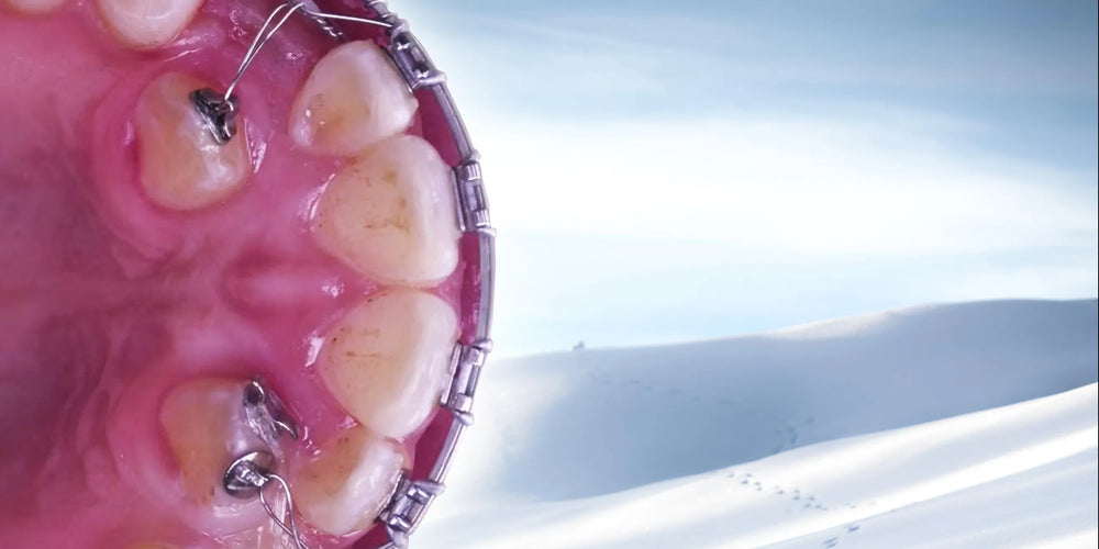 Clinical Orthodontics: Treatment of Complex Clinical Cases