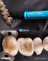 The Biomimetic Concept: Composite Restoration Protocols