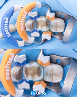 The Biomimetic Concept: Composite Restoration Protocols