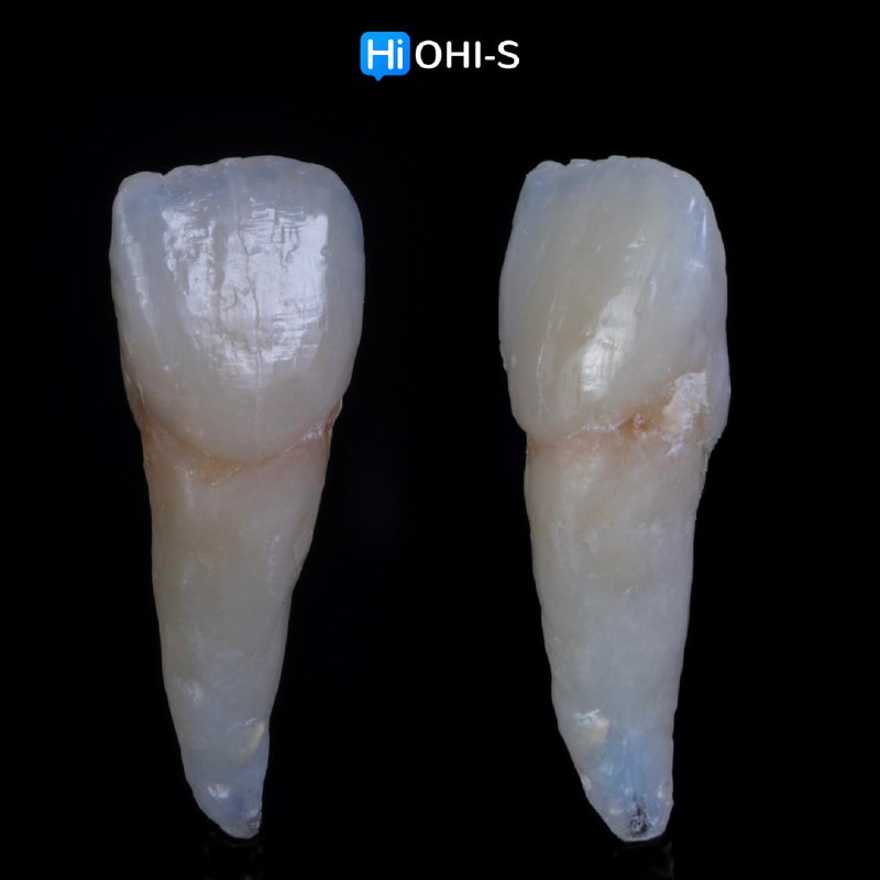 High-Aesthetic Restorations