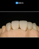 Ceramic Layering: Protocols from the World's Leading Schools