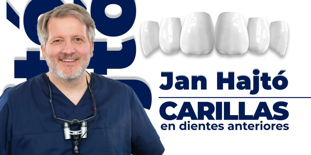 Anterior Tooth Veneers: A Digital Protocol for Fabricating Functional and Esthetic Restorations