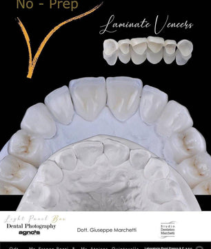 Ceramic Restorations:  Veneers, Inlays, Crowns - Dental Courses | كورسات طب اسنان