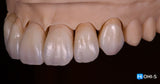 Aesthetic Dentistry Online Congress: Programs by Klaus Müterthies, Edris Rasta and Maurizio De Stefano