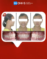 Orthodontics for Children and Teenagers