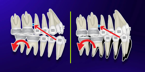 Orthodontic Treatment Mistakes: Camouflage and Retreatment Protocols for Compromised Cases