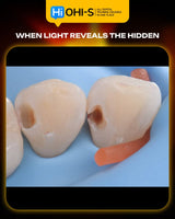 International Schools Working with Composite Restorations