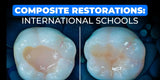 International Schools Working with Composite Restorations