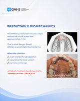 Biomechanics in Orthodontics
