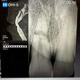 Dental Trauma Without Drama