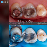 The Biomimetic Concept: Composite Restoration Protocols