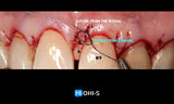 Advanced Periodontology: Surgical Protocols