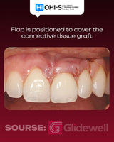 Advanced Periodontology: Surgical Protocols