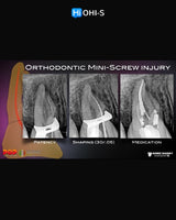 Saving Hopeless Teeth: Surgical and Conservative Protocols